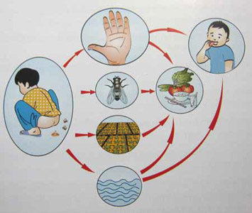 Diệt ruồi tận gốc 